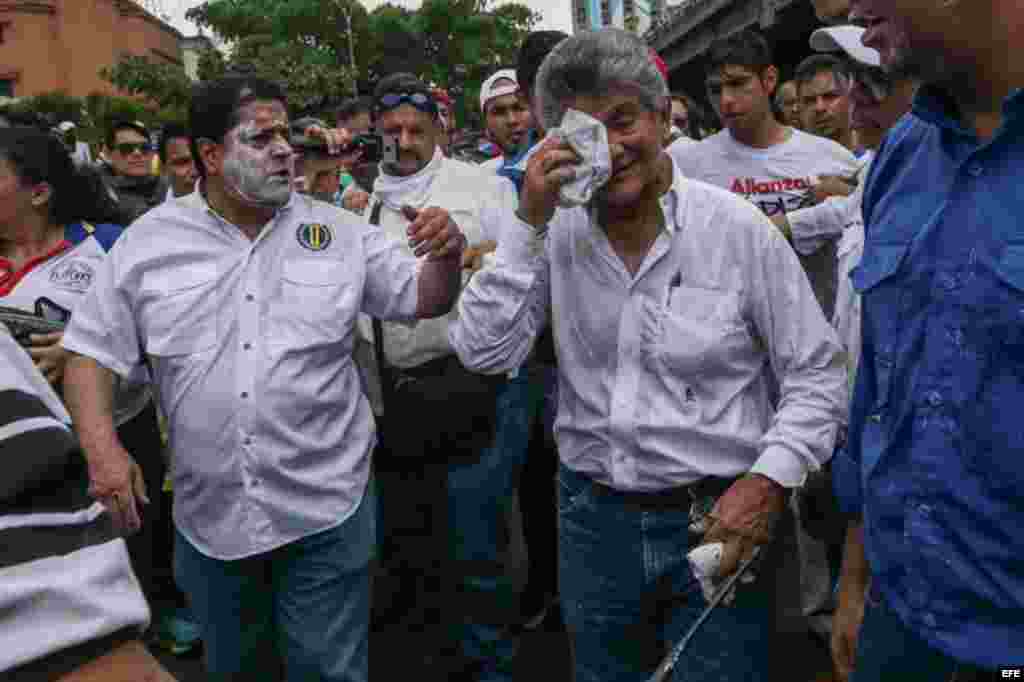 El diputado de la Asamblea Nacional (AN), Henry Ramos (d), limpia su rostro después de tener contacto con gases lacrimógenos.