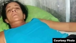 Sonia de la Caridad González Mejías, activista de (UNPACU), luego de ser liberada el 30 de Julio de 2017. Cortesía Serafín Morán.